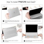 MOSISO Compatible with MacBook Neo Case 13 inch 2026 A3404 A18 Pro Chip | 4 in 1 Kit Precision Fit Crack & Scratch Resistant Protective Hard Shell Case Cover, Crystal Clear
